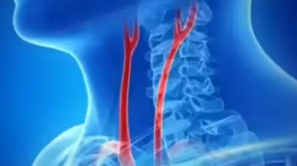 মুখ-গলার ৫ সংকেতেই ধরা পড়তে পারে কিডনি রোগ!/Kidney disease can be detected by 5 signs in the mouth and throat!